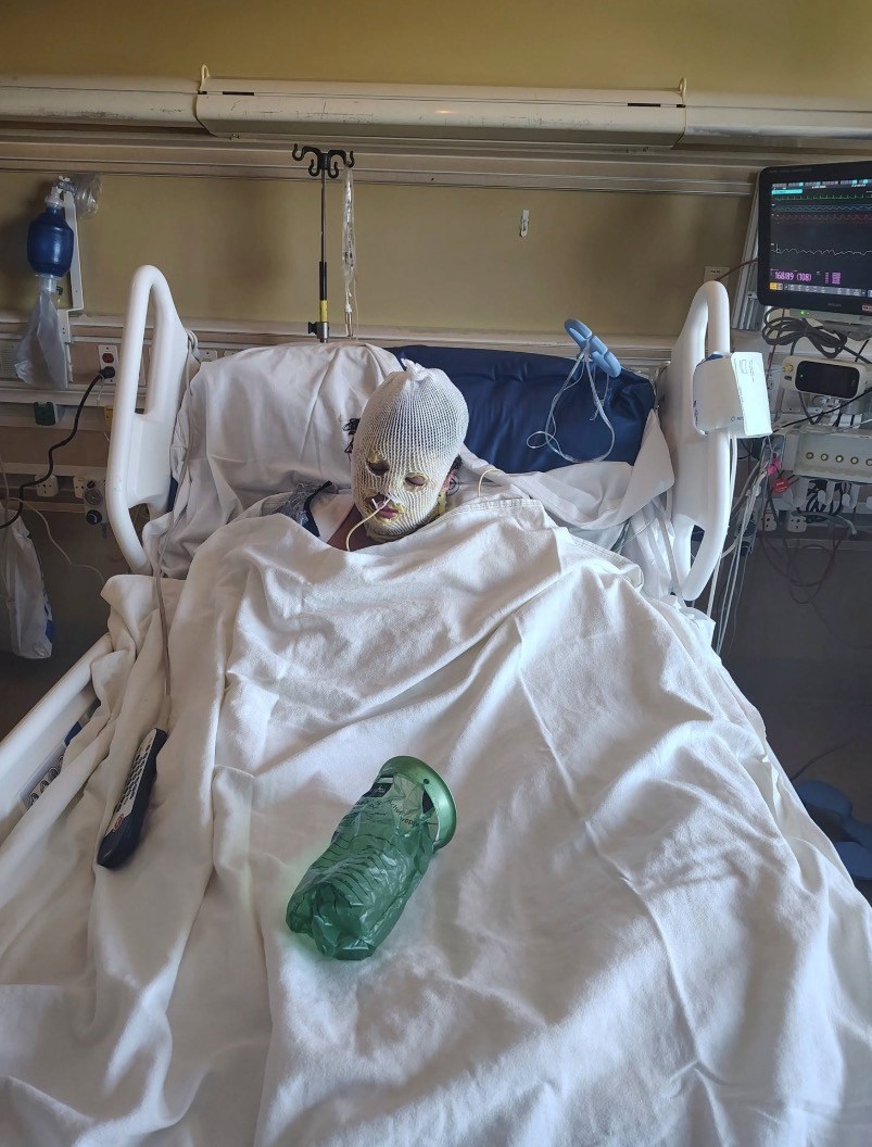 Family begs for justice after woman set on fire at California homeless camp dies